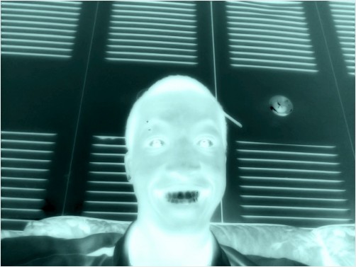 x ray